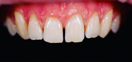 Before Image