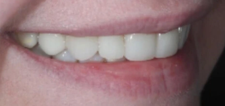 After Image
