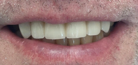 After Image