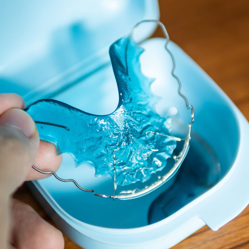 How-to-Take-Care-of-Your-Retainer