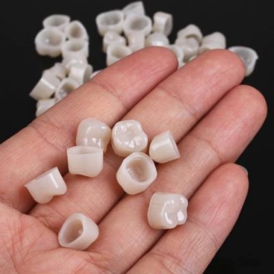 Do I Need a Temporary Crown?