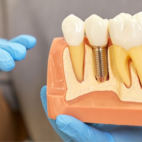 xr:d:DAFr4iCuMDo:75,j:3947807882528166493,t:23091318