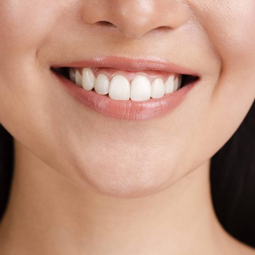 woman-s-smile-with-clear-skin-scaled